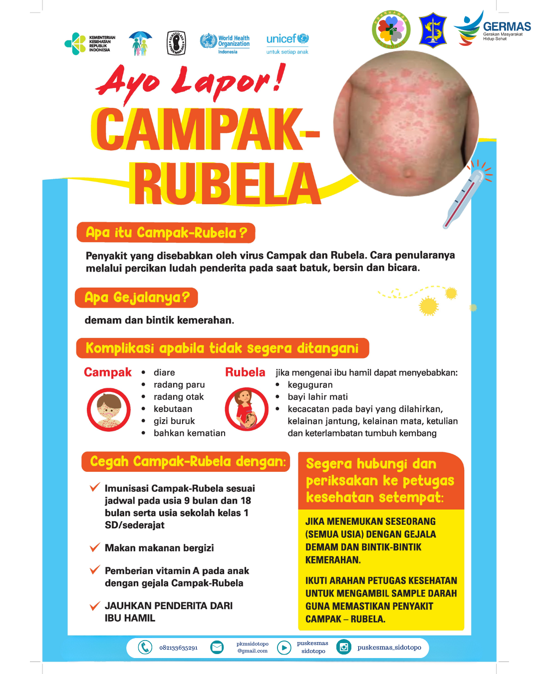 Kenali Campak-Rubella